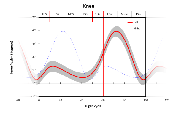 Knee graph